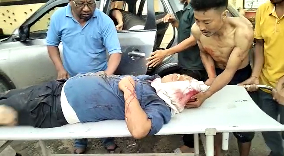 Attack by Khasi miscreants I পশ্চিম কাৰ্বি আংলঙত খাচী দুৰ্বৃত্তৰ আক্ৰমণ : এজন গুৰুতৰভাৱে আহত 3 khasip2 | ASSAM TIMES POST