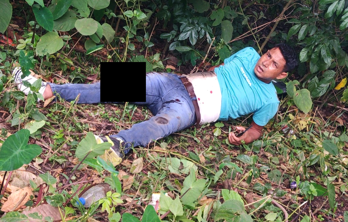 accip3 1 | ASSAM TIMES POST