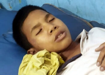 Burrowing poisoning : ডিফুত মুড়ি খাই এটি কিশোৰৰ মৃত্যু! দুটি শিশু গুৰুতৰ বাবে অসুস্থ হৈ ডিএমচিএইছত চিকিৎসাধীন 9 Burrowing poisoning : ডিফুত মুড়ি খাই এটি কিশোৰৰ মৃত্যু! দুটি শিশু গুৰুতৰ বাবে অসুস্থ হৈ ডিএমচিএইছত চিকিৎসাধীন